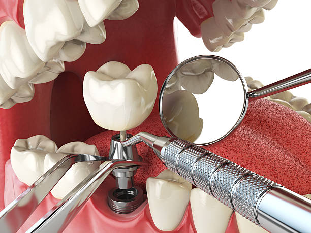 Best Emergency Tooth Extraction in Woodstown, NJ